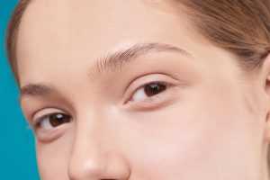 close up photo of a woman after a microdermabrasion treatment